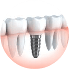 dentysta - implanty koszalin