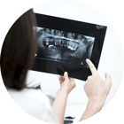 dentysta kozalin - rekonstrukcja kości